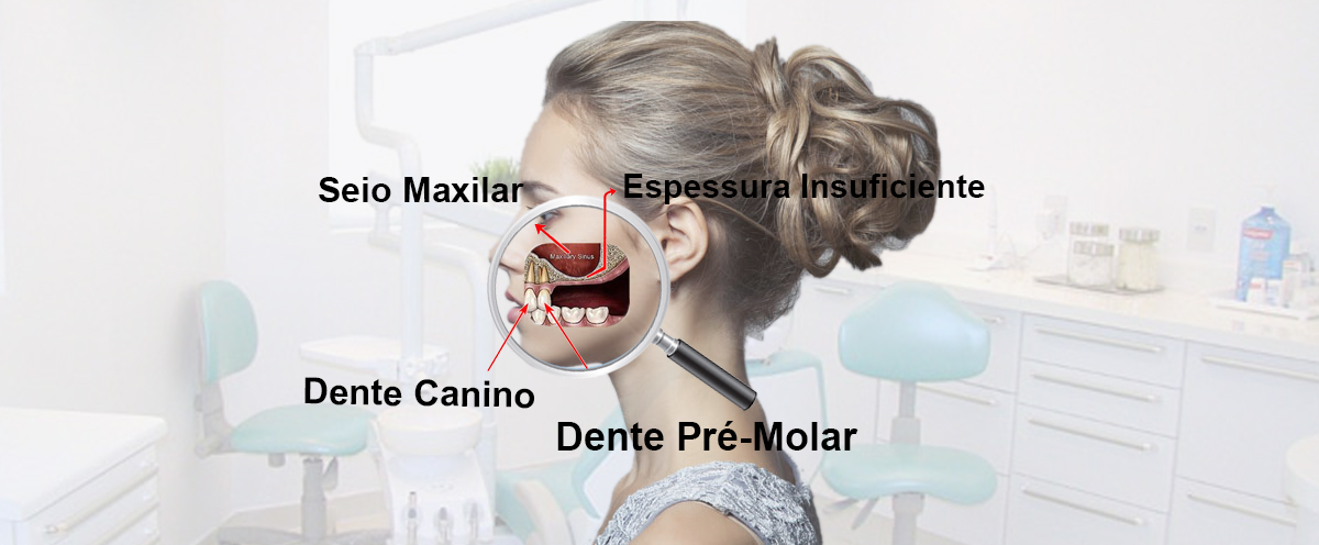 Inepo Cursos Seio Maxilar 2